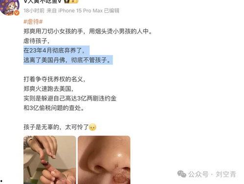 吃瓜爆料免费进最新网站,免费畅游吃瓜爆料最新网站,独家攻略大公开! 第1张 吃瓜爆料免费进最新网站,免费畅游吃瓜爆料最新网站,独家攻略大公开! 第1张